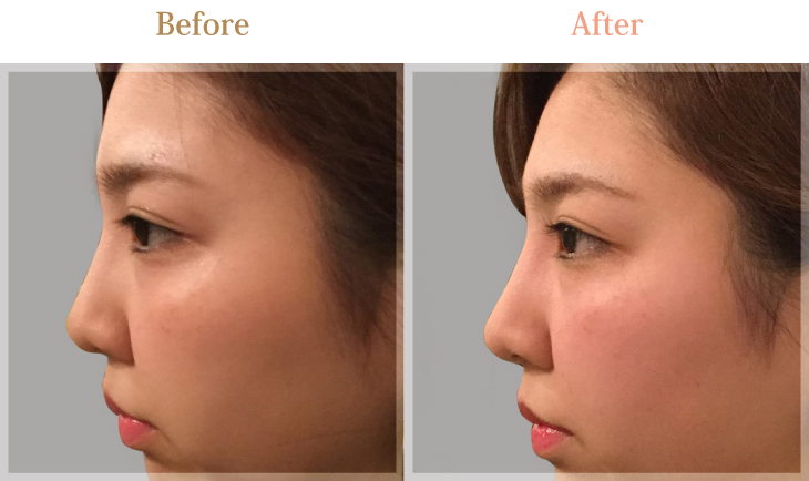 ビフォーアフター02